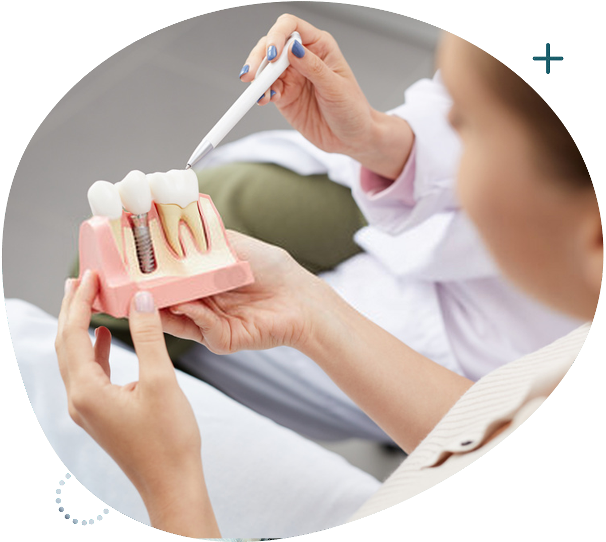 Dental Implants